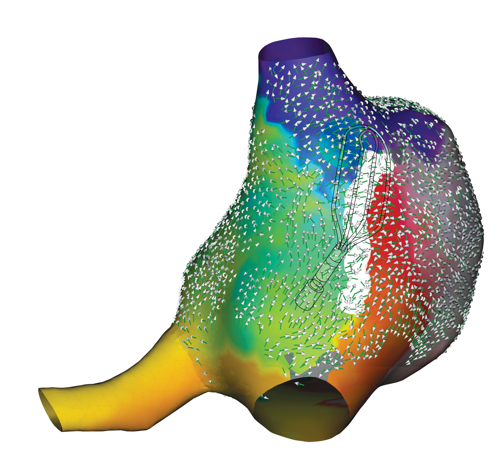 EnSite X④ EnSite Omnipolar Technology_ Right Atrial Map with HD Grid.png
