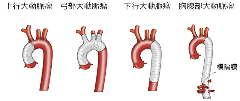 stent_img07.jpg